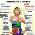 /album/fotogaleria/disfuncio-tiroides-jpg/